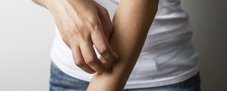 image of a person scratching their forearm