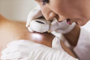 image of dermatologist inspecting a patient's skin for skin cancer