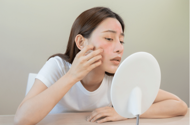 Young woman with red spot or rash on face