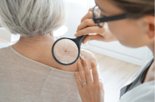 Senior woman getting skin checked by dermatologist