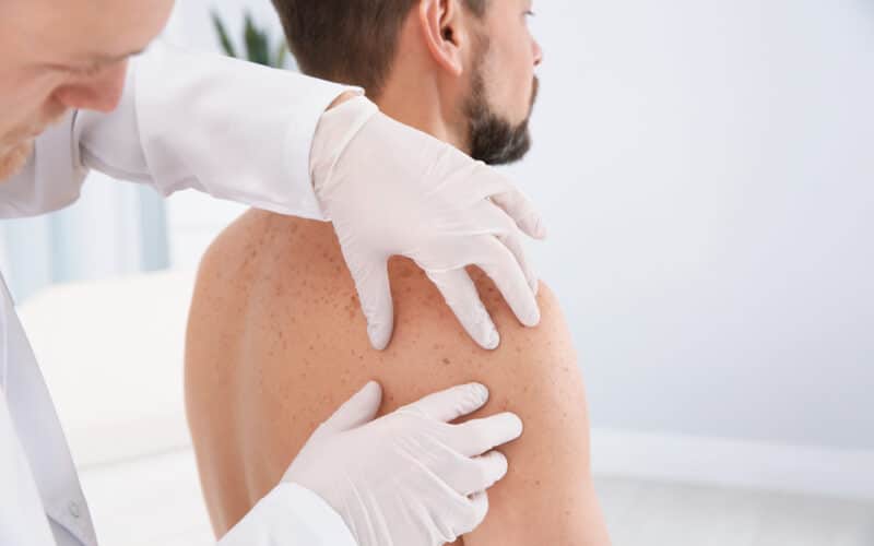 Dermatologist examining patient's birthmark in clinic