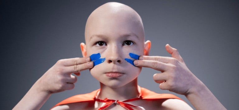 adolescent-alopecia-areata
