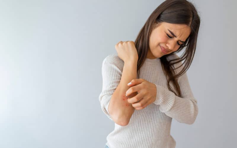 A woman with eczema scratching her arm