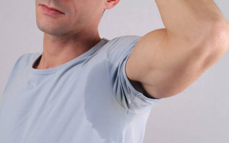 A close-up shot of a man with hyperhidrosis and his underarm sweat