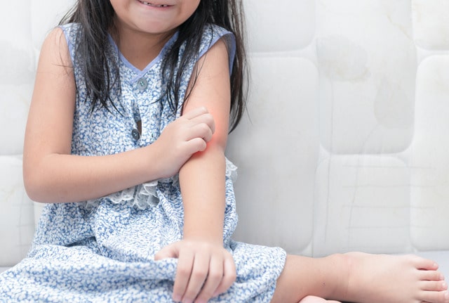 A cropped shot of a young girl with atopic dermatitis scratching her arm